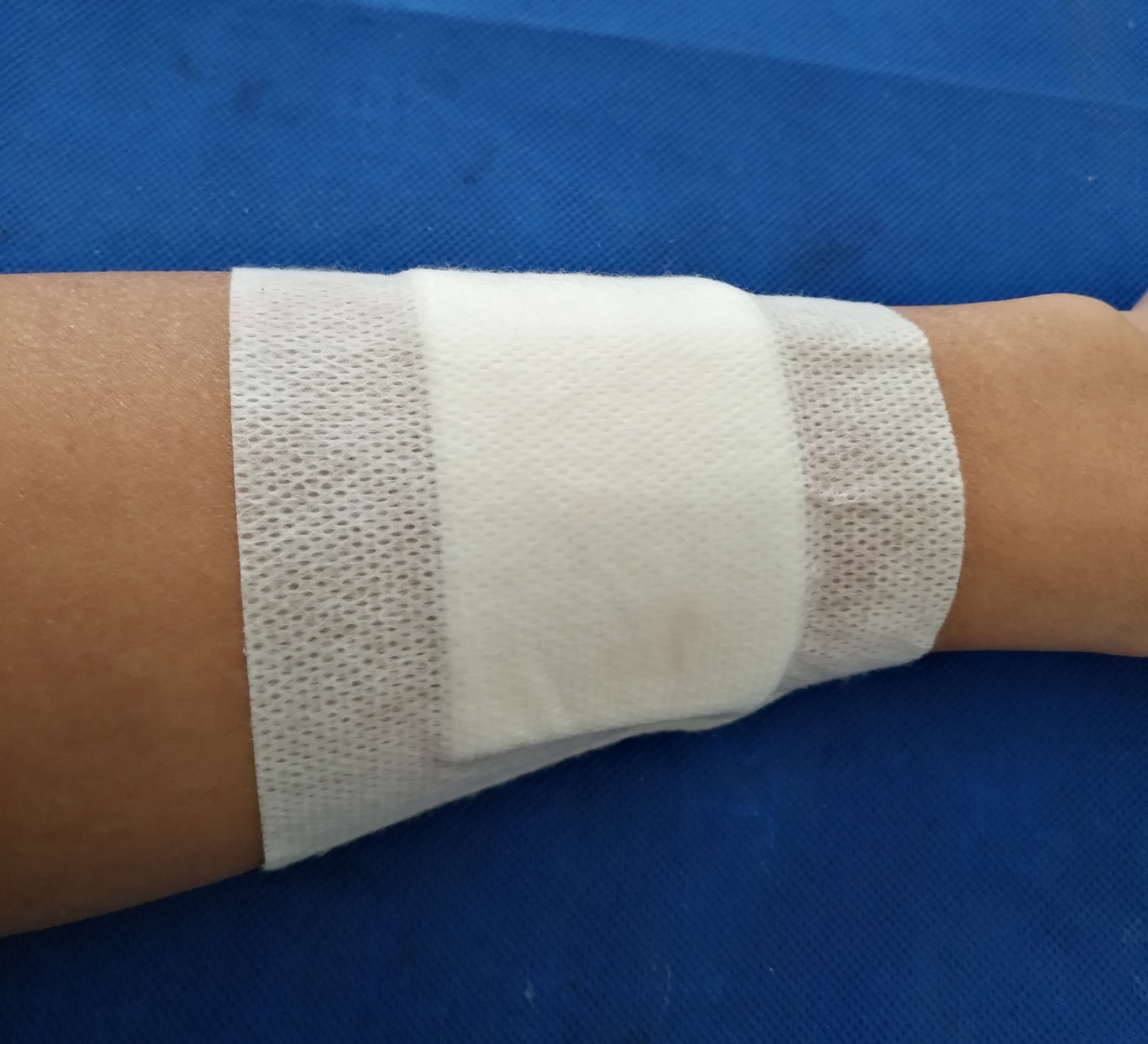 Hemostatic gauze 