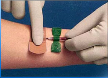 Hemostatic pressure bandage  for dialysis