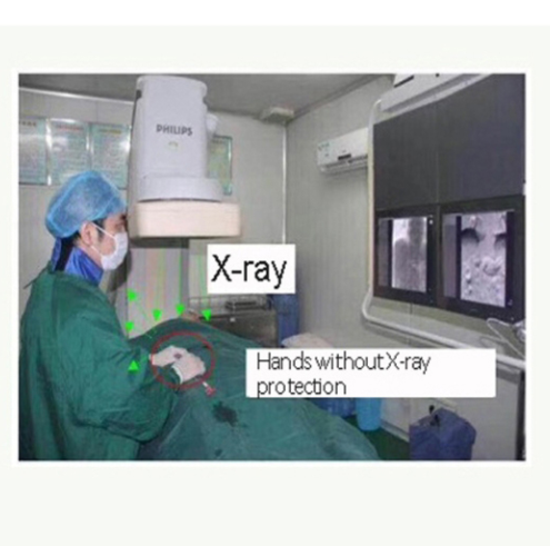 China Radiation gloves