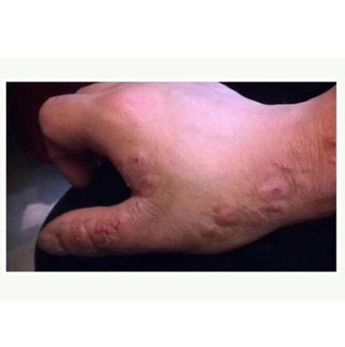 China Radiation gloves
